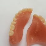 broken denture